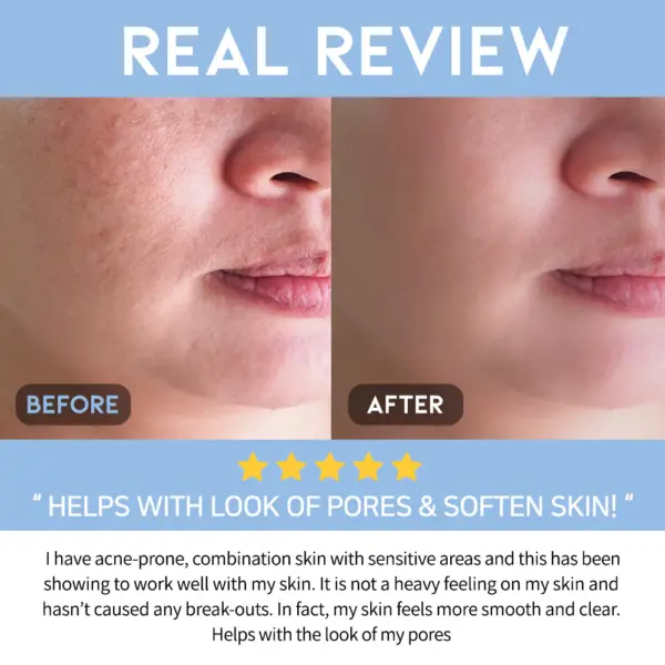 OOTD AHA BHA Clarifying Serum 50ml 2 OOTD AHA BHA Clarifying Serum 50ml