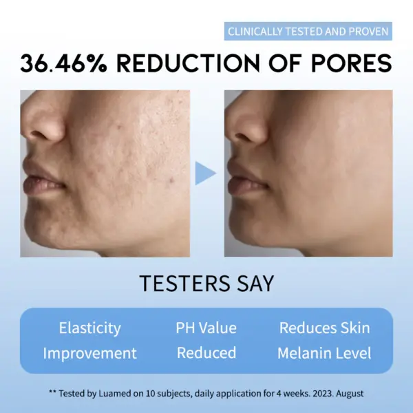 OOTD AHA BHA Clarifying Serum 50ml 3 OOTD AHA BHA Clarifying Serum 50ml