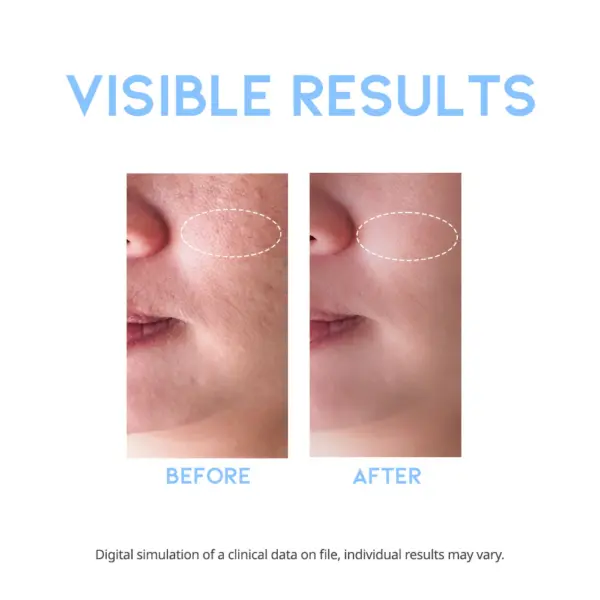 OOTD AHA BHA Clarifying Toner 250ml 4 OOTD AHA BHA Clarifying Toner 250ml