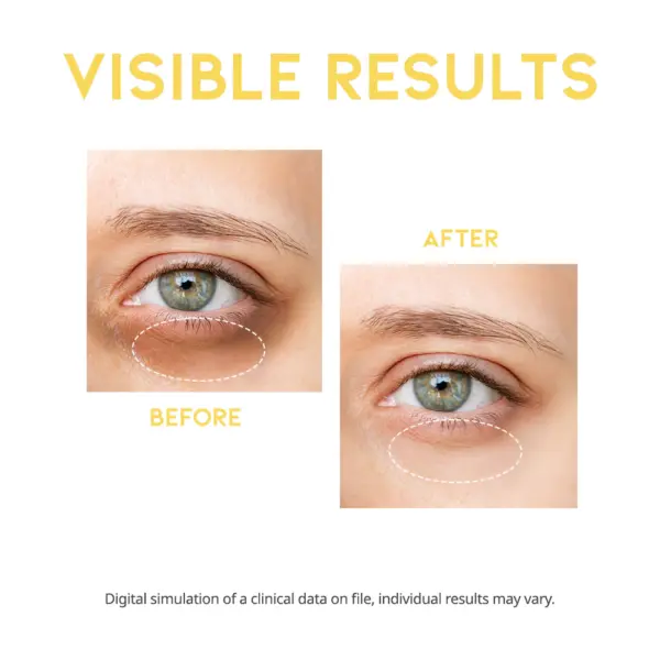 OOTD Dark Circle Eye Serum 30gr 4 OOTD Dark Circle Eye Serum 30gr