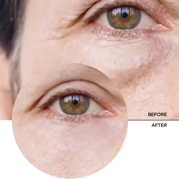 Revox Just Caffeine 5% Eye Contour Serum 30ml 6 Revox Just Caffeine 5% Eye Contour Serum 30ml