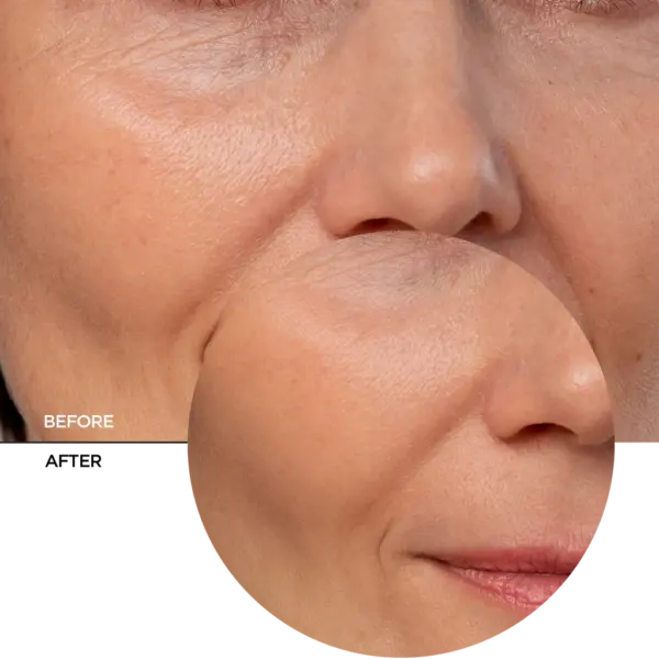 Revox Just Coenzyme Q10 Anti-Aging Serum 30ml