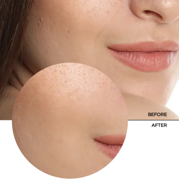 Revox Just Hyaluronic Acid 5% Serum 30ml