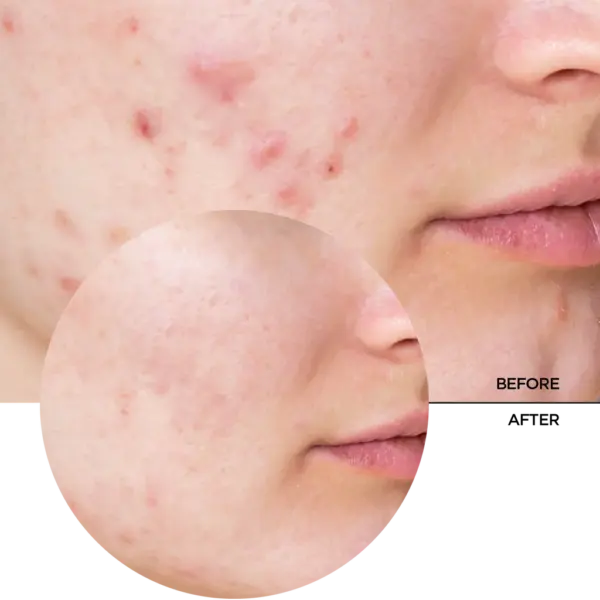 Revox Just Niacinamide 10% Serum 30ml