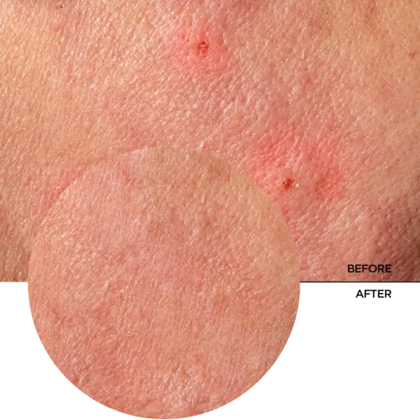 Revox Just Provitamin B5 and Centella Soothing Balm 30ml