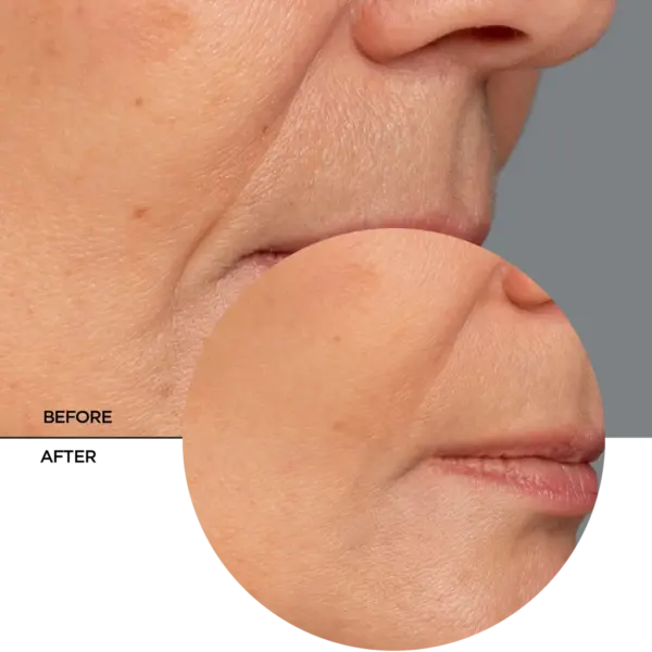 Revox Retinol Anti-Wrinkle Serum 30ml