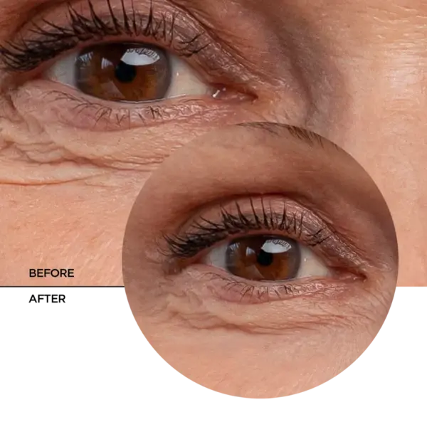 Revox Retinol Eye Contour Gel 30ml 6 Revox Retinol Eye Contour Gel 30ml