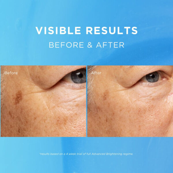 Fadeout Advanced Brightening Day Cream SPF20 50ml