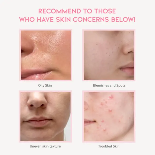 OOTD Clarifying Niacinamide Serum 50ml 3 OOTD Clarifying Niacinamide Serum 50ml