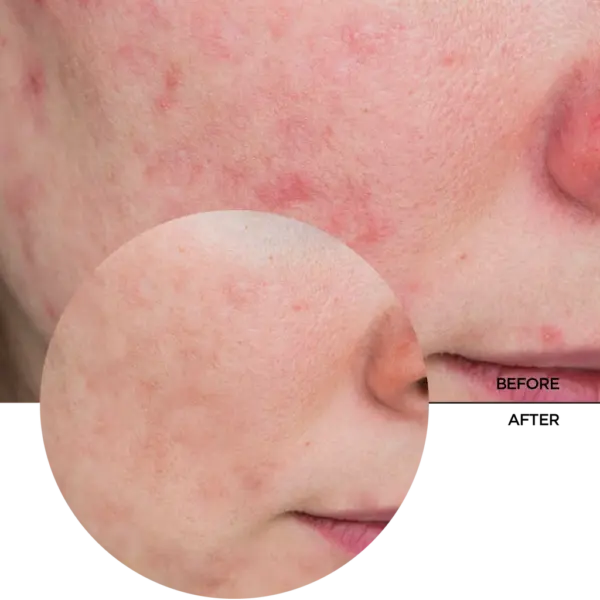 Revox Azelaic Acid 10% Brightening Solution 30ml