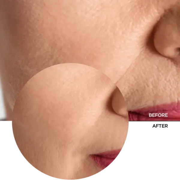 Revox Just Collagen Amino Acids +HA Moisturising Solution 30ml