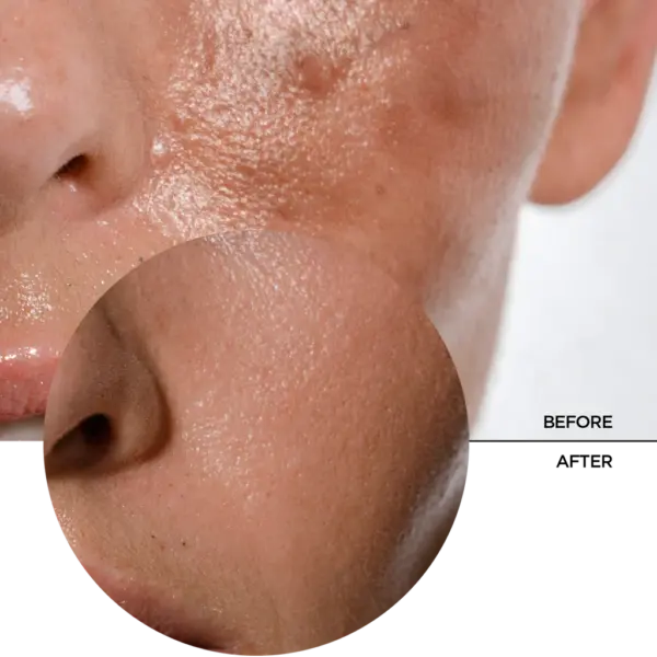 Revox Just Daily Sun Shield SPF50 Oily Skin 30ml