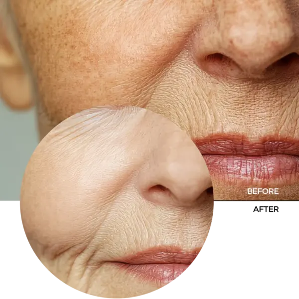 Revox Just Glycolic Acid 20% Toning Lotion 30ml