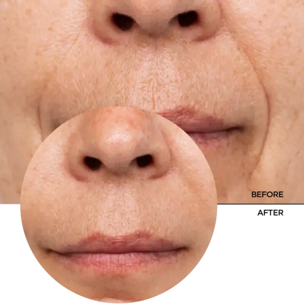 Revox Just Retinol in Squalane Age Control 30ml 7 Revox Just Retinol in Squalane Age Control 30ml