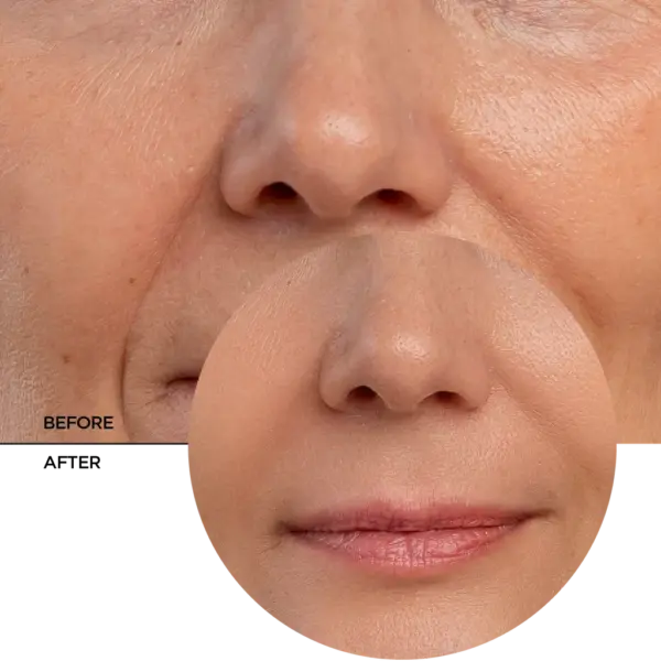 Revox Retinal Anti Aging Serum 30ml