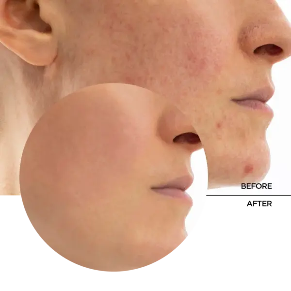 Revox Biotic Rebalancing Smoothing Gel 50ml