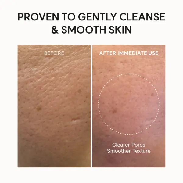 Arencia Fresh Rosehip Rice Mochi Cleanser- Διπλός καθαρισμός σε ένα βήμα 120gr 7 Arencia Fresh Rosehip Rice Mochi Cleanser- Διπλός καθαρισμός σε ένα βήμα 120gr